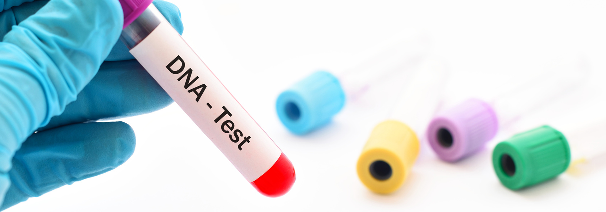banner-dna-test