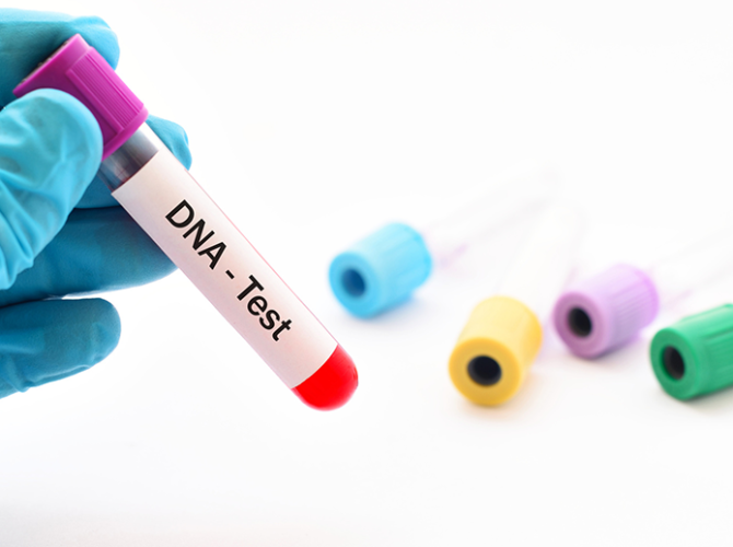 dna-test