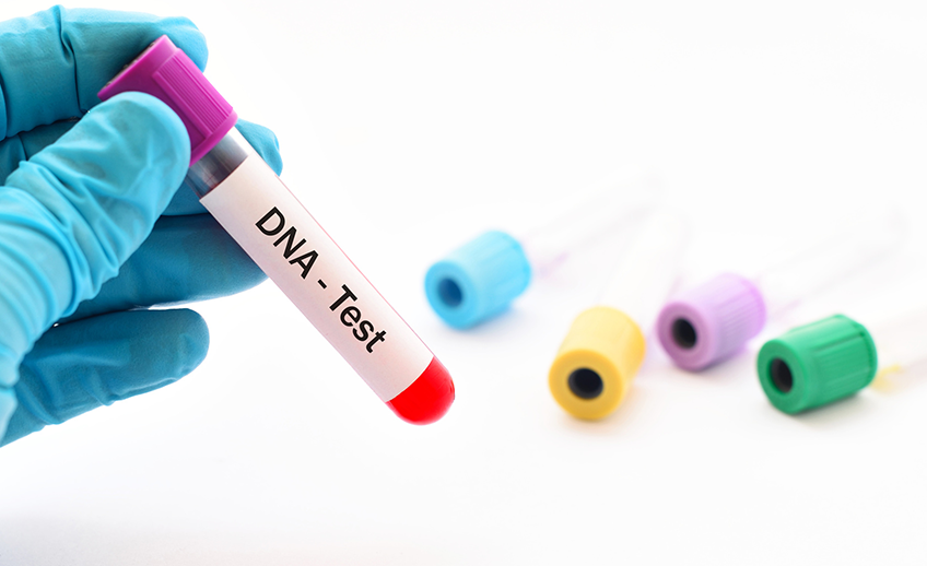 dna-test